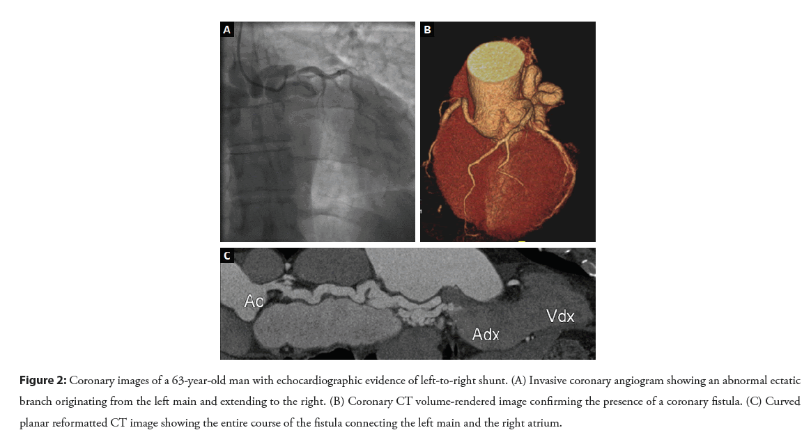 interventional-echocardiographic