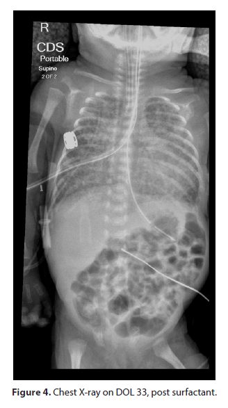 journal-neonatal-surfactant