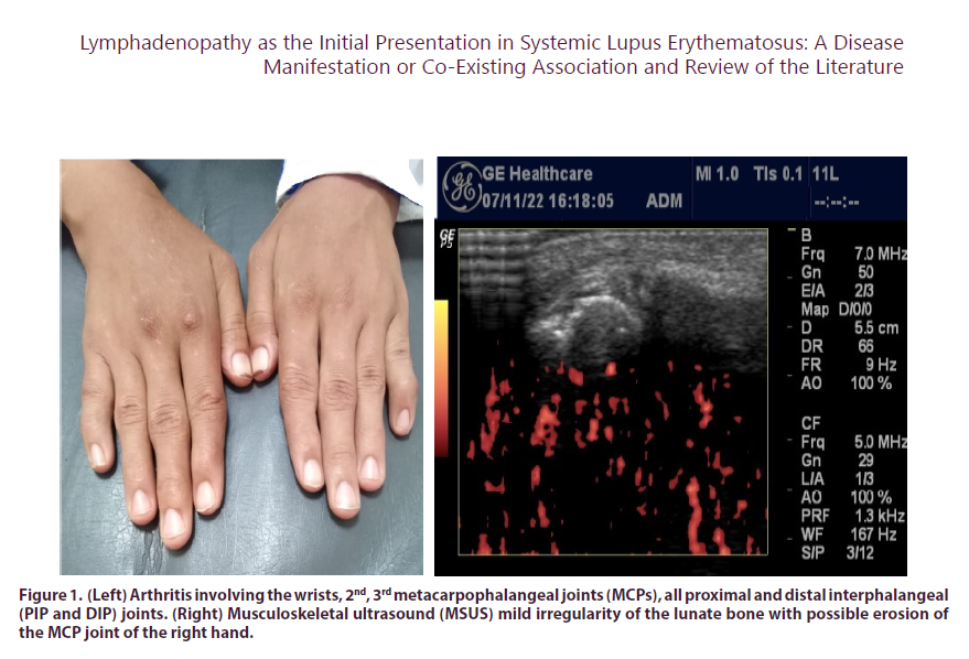 clinical-rheumatology-Left