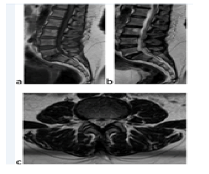 fmci-13-1-MRI