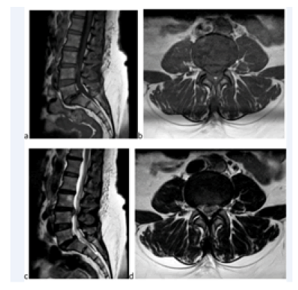 fmci-13-1-Sagittal