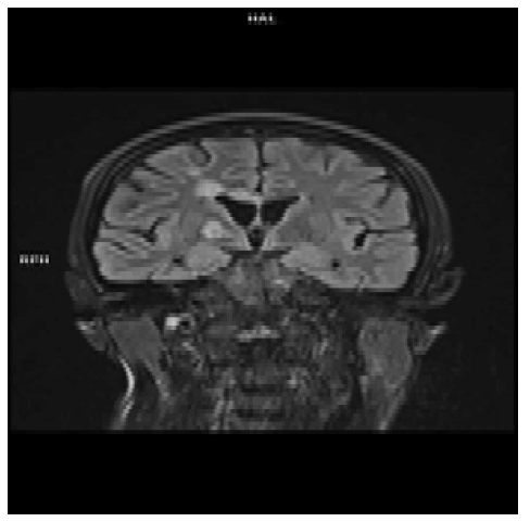 fmci-13-3-Th