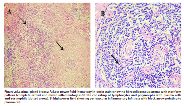 international-journal-gland