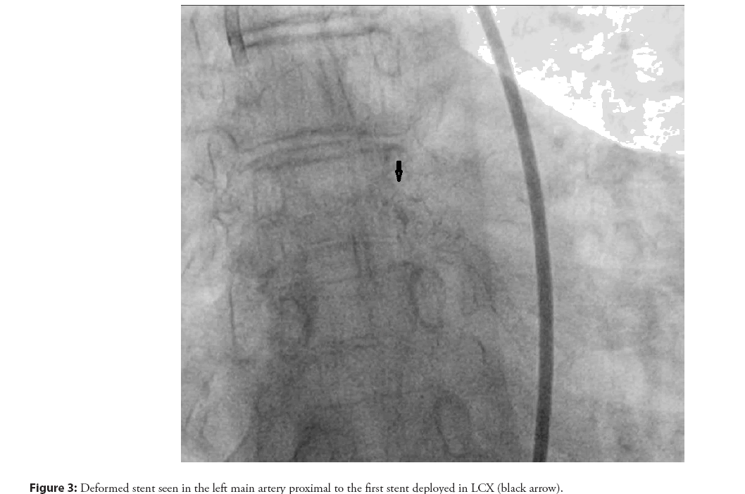 interventional-cardiology-artery