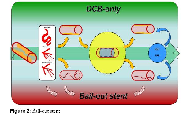interventional-cardiology-bail