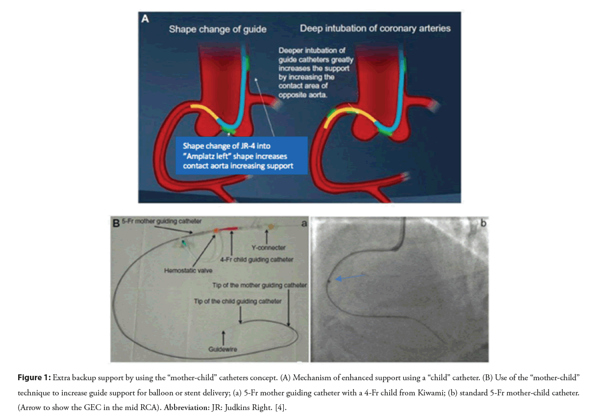 interventional-cardiology-catheters