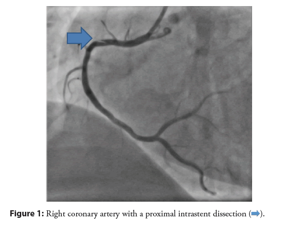 interventional-cardiology-coronary