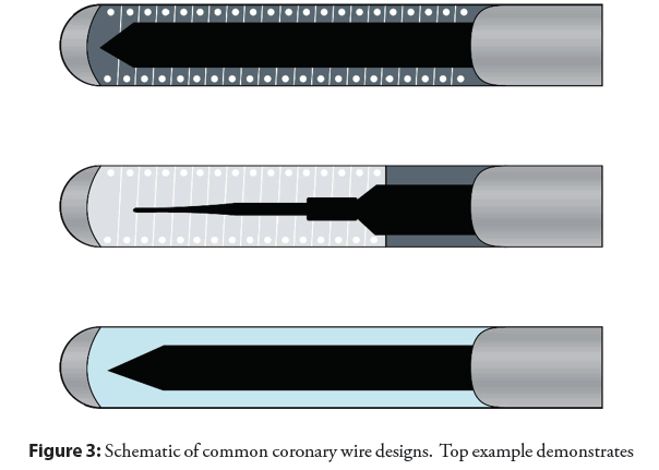 interventional-cardiology-coronary