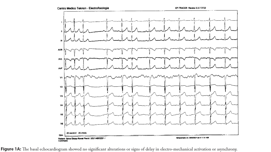 interventional-cardiology-echocardiogram