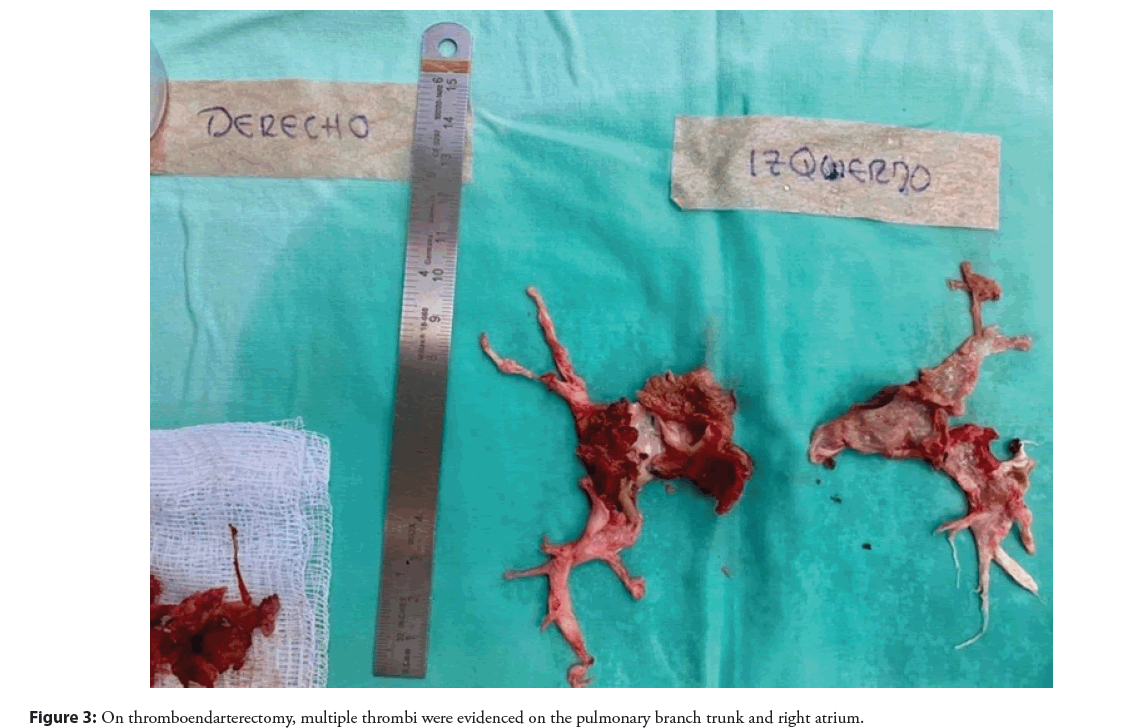 interventional-cardiology-evidenced