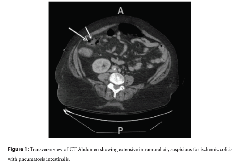 interventional-cardiology-intramural