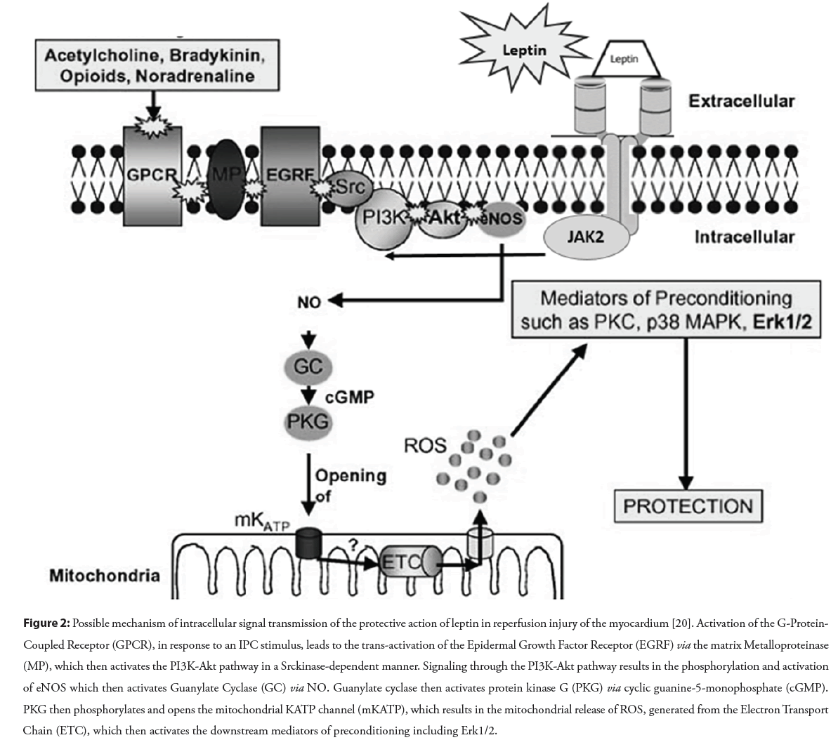 interventional-cardiology-leptin