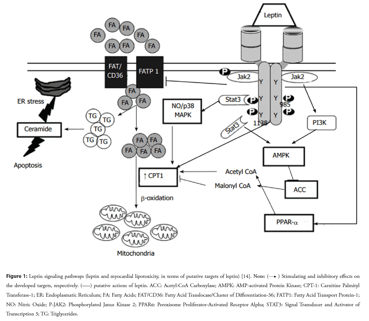 interventional-cardiology-lipotoxicity