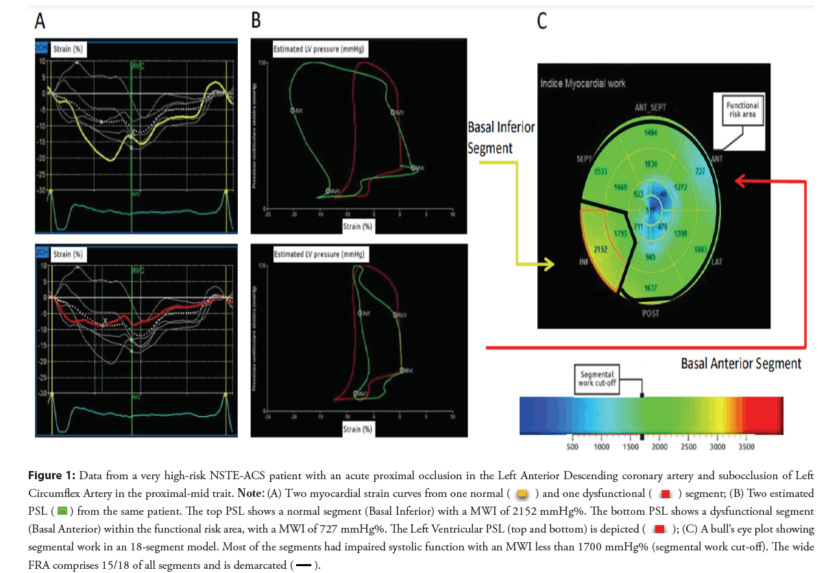 interventional-cardiology-occlusion