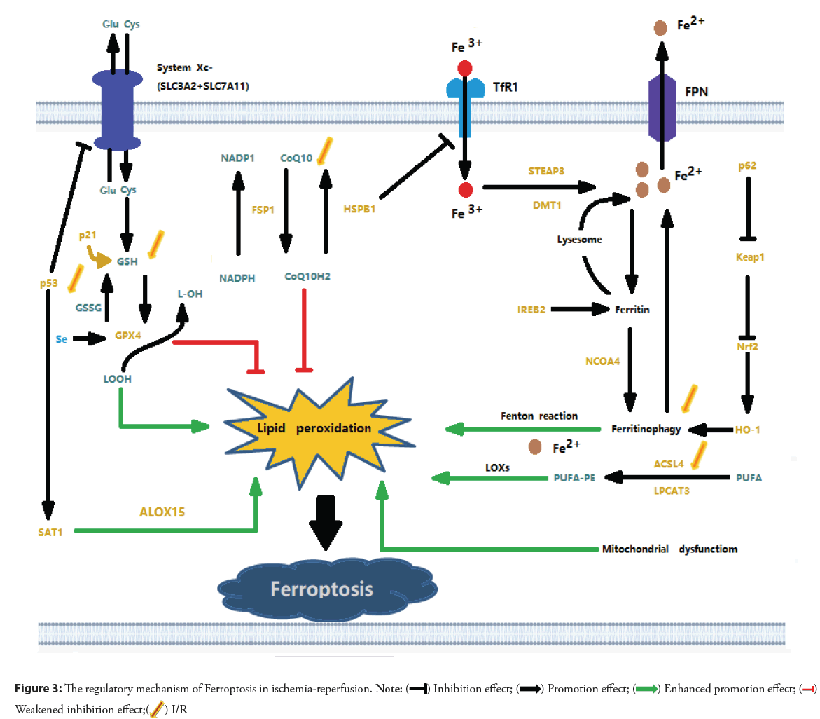 interventional-cardiology-reperfusion