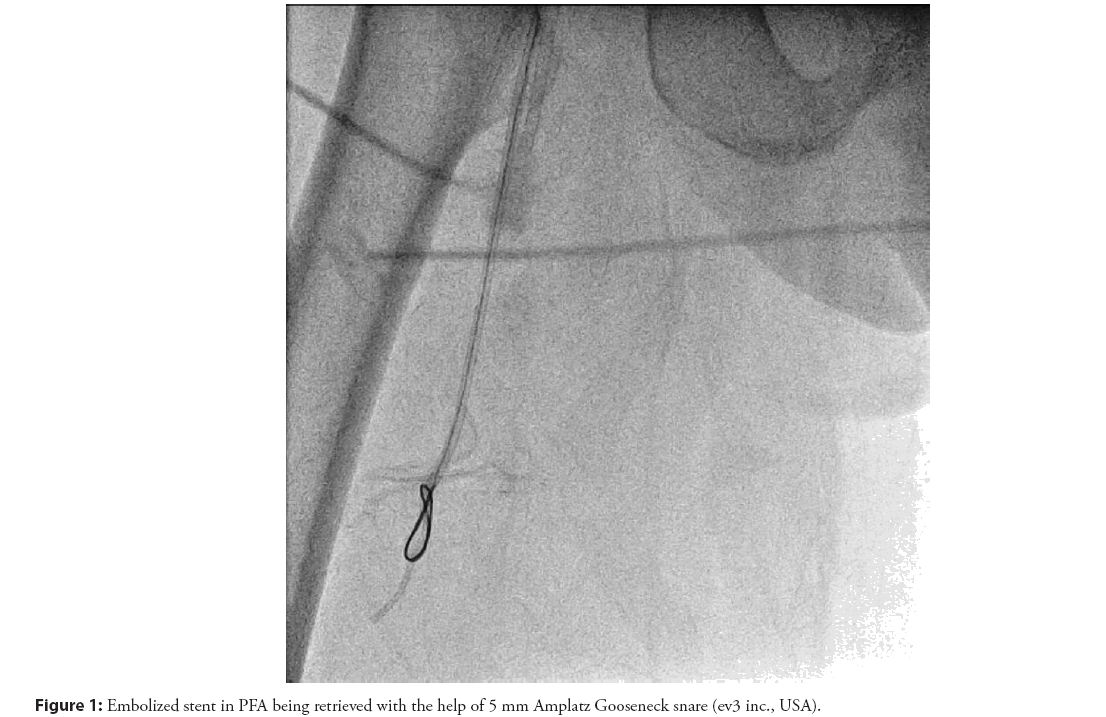 interventional-cardiology-retrieved