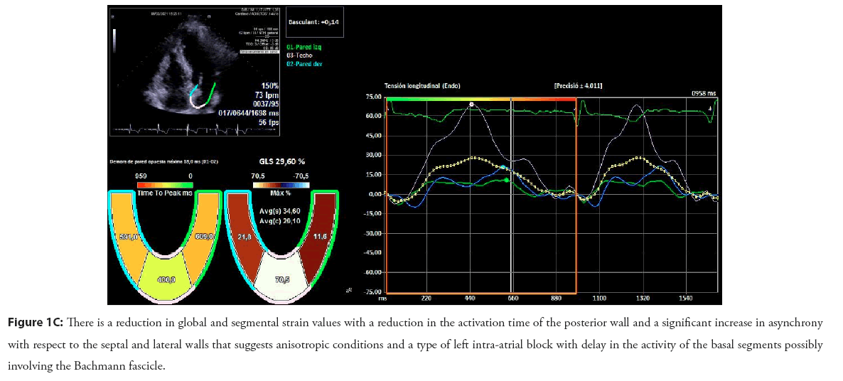 interventional-cardiology-segmental