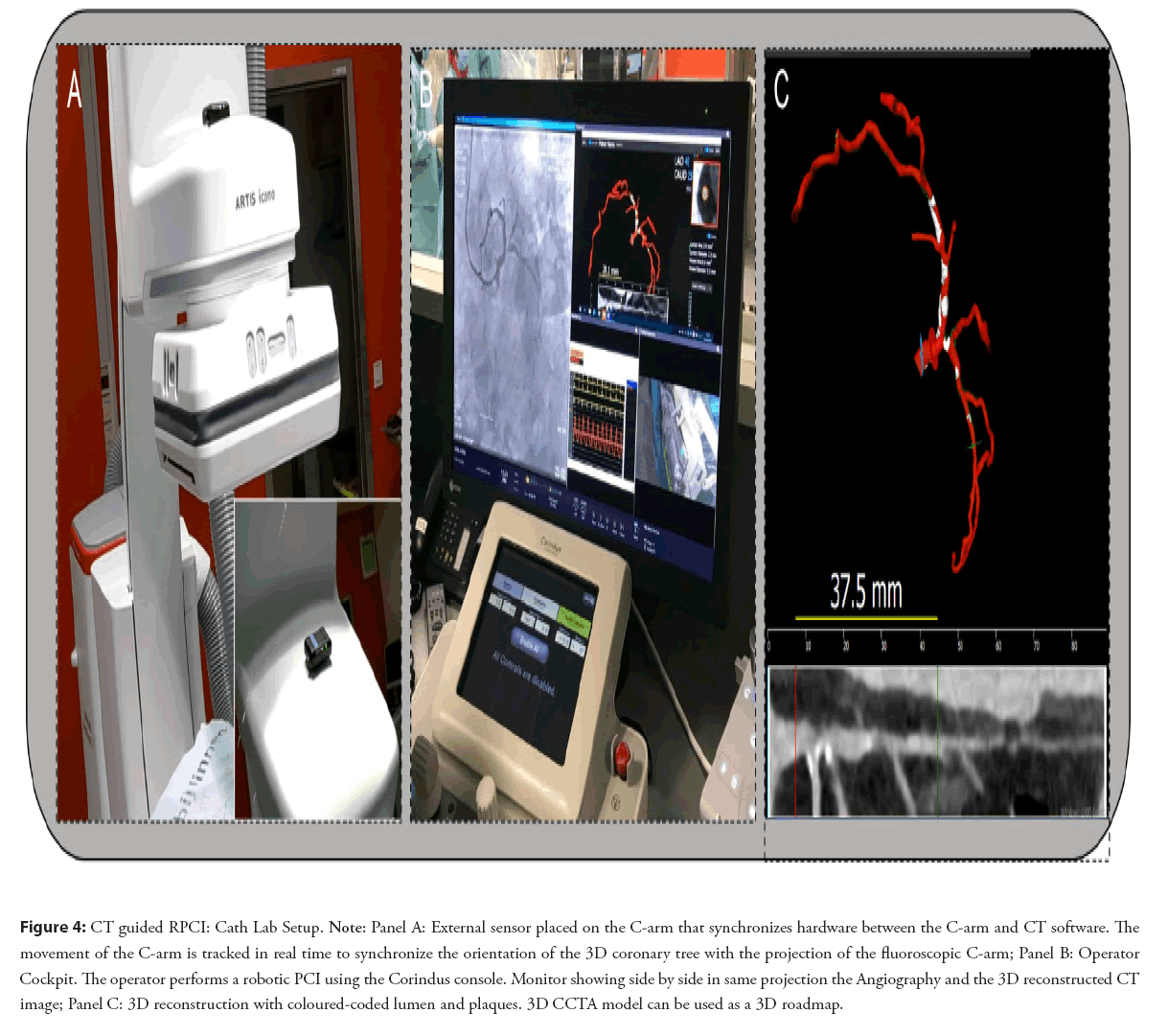 interventional-cardiology-sensor