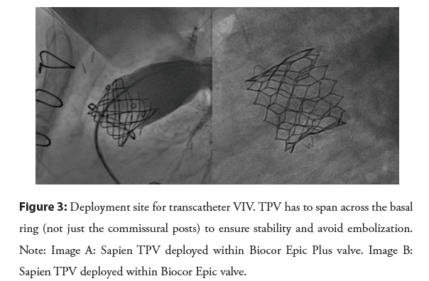 interventional-cardiology-stability