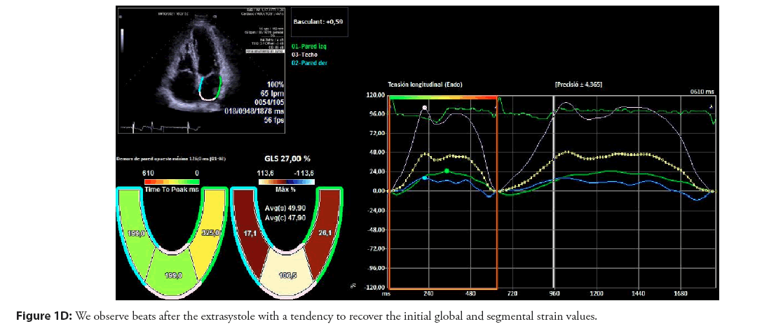 interventional-cardiology-tendency