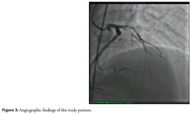 interventional-angiographic
