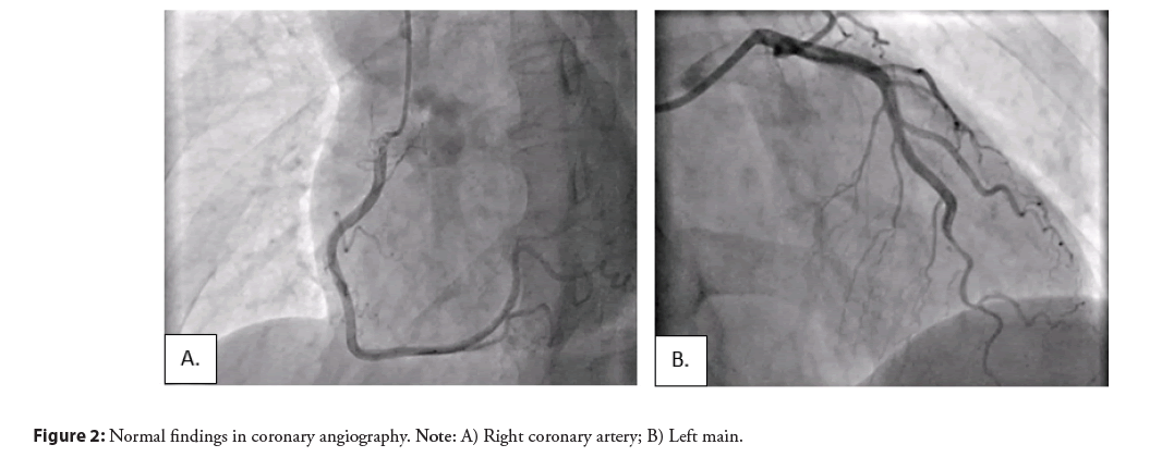 interventional-cardiolog-angiography