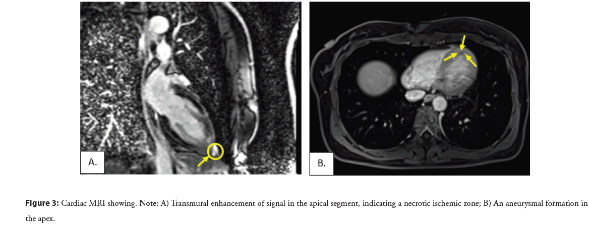 interventional-cardiolog-enhancement