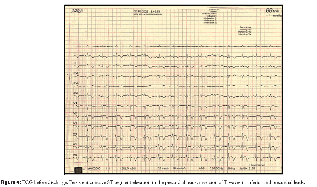interventional-cardiolog-precordial