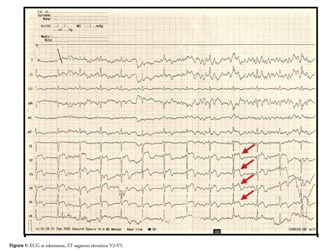 interventional-cardiolog-segment