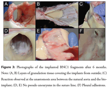 interventional-cardiology-anastomosis