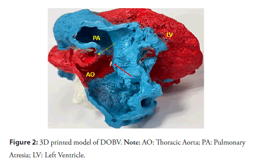 interventional-cardiology-pulmonary