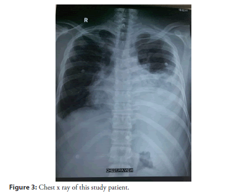 interventional-cardiology-ray