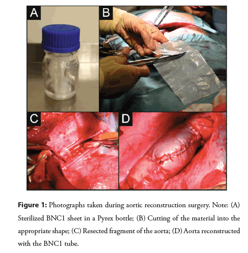 interventional-cardiology-reconstruction