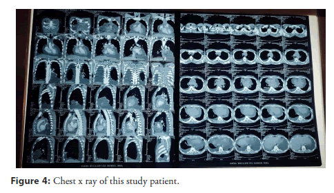 interventional-cardiology-study