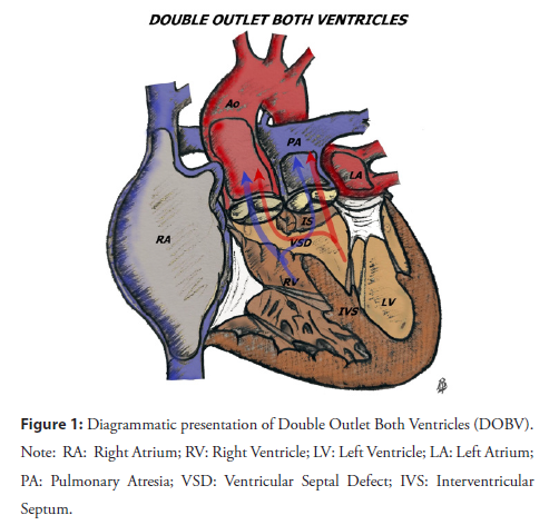 interventional-cardiology-ventricles