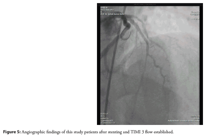 interventional-established