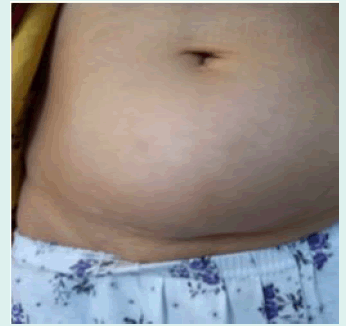 Fmdm-region Fmdm-region