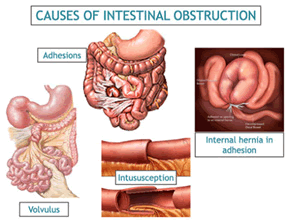 fmci-intestinal