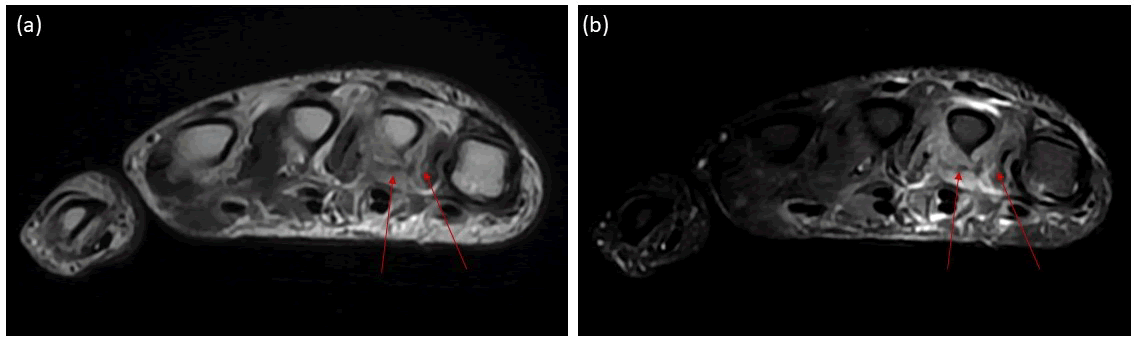 jagri-self jagri-self
