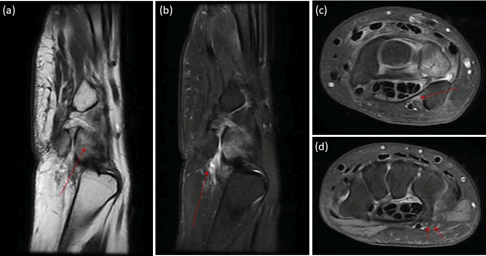 jagri-self jagri-self