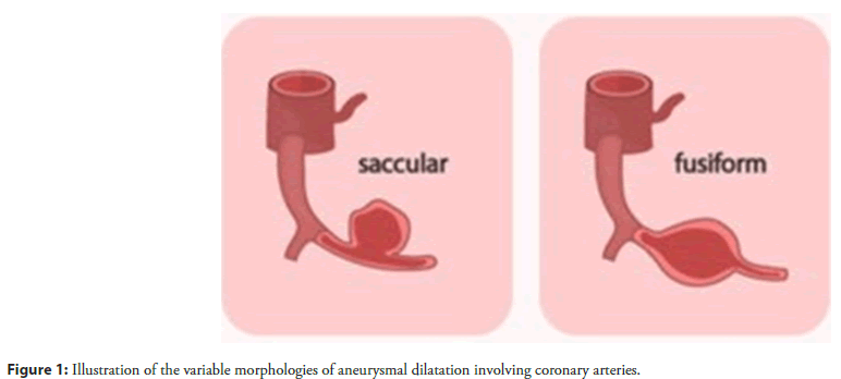 interventional