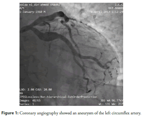 interventional