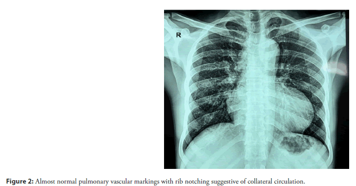 neuropsychiatry-Search-strategy-inclusion