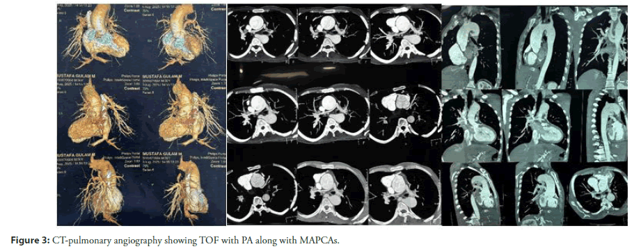 neuropsychiatry-Search-strategy-inclusion
