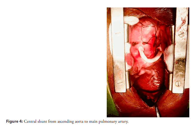 neuropsychiatry-Search-strategy-inclusion