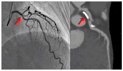 neuropsychiatry-Search-strategy-inclusion