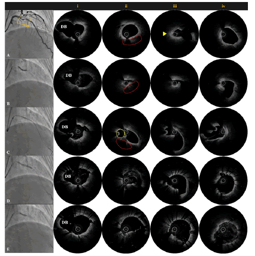 neuropsychiatry-Search-strategy-inclusion