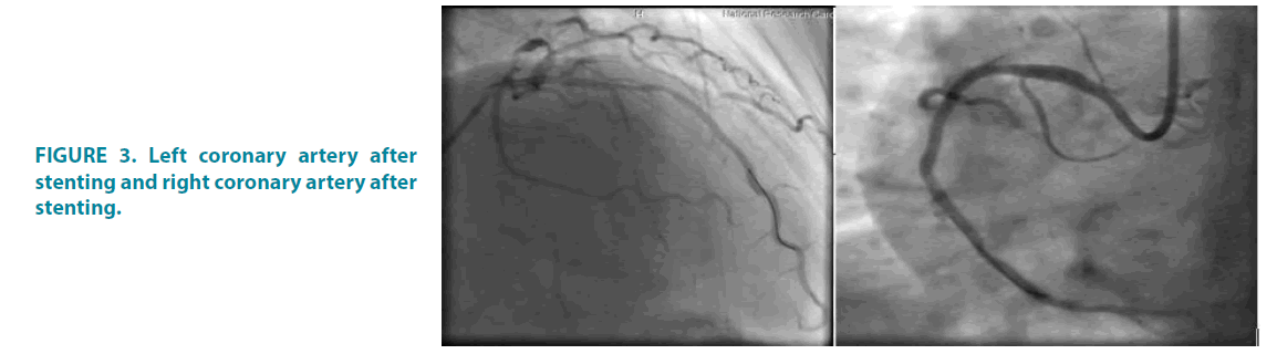 Clinical-Practice-stenting