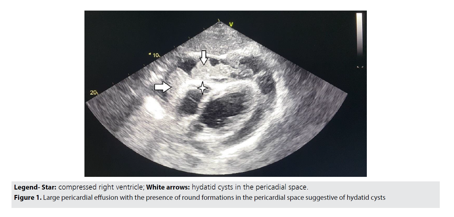 Imaging-Med-Large-pericardial
