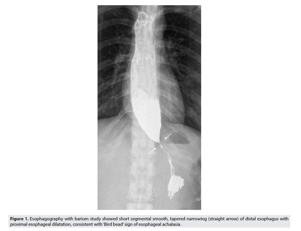 Imaging-Med-distal-esophagus